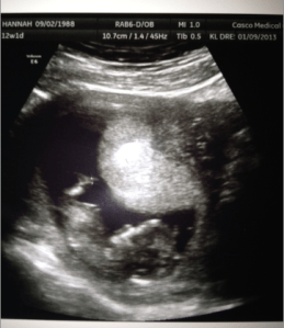 All the pics this week were blurry because baby was moving so much!