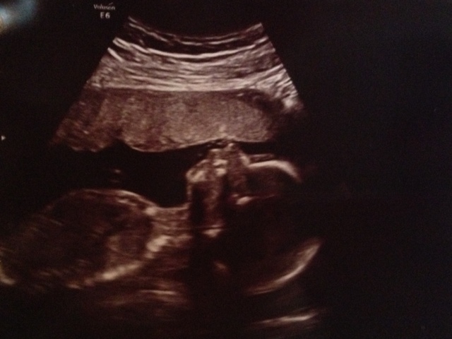 Baby Richards at 21 weeks