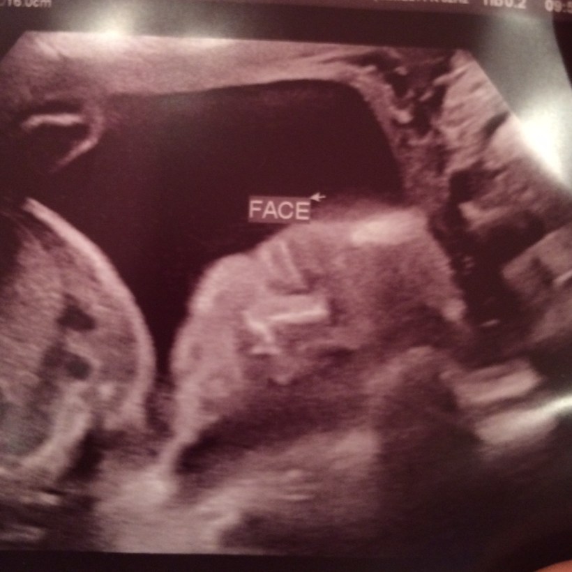 Baby Richards #2 - 23 weeks